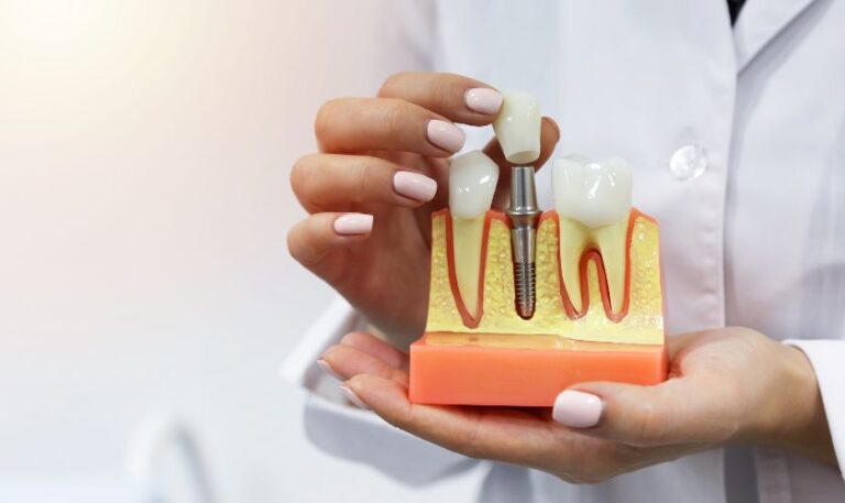 Dental Implants San Antonio, TX