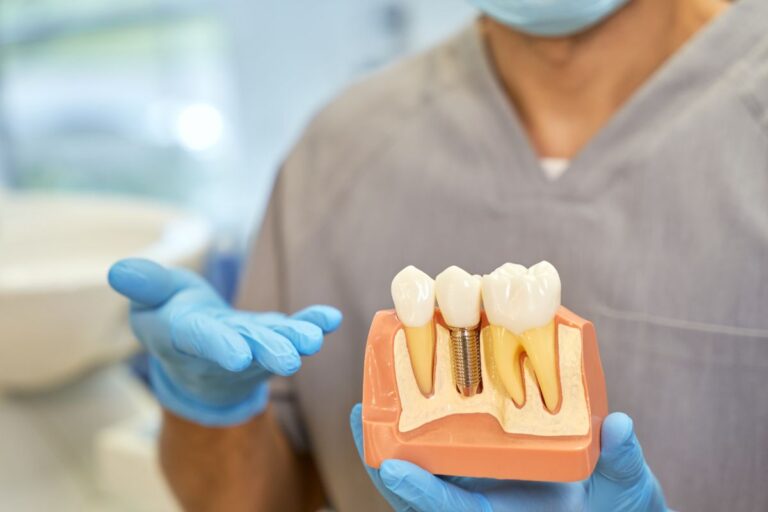 Dental Implants Treatment in San Antonio