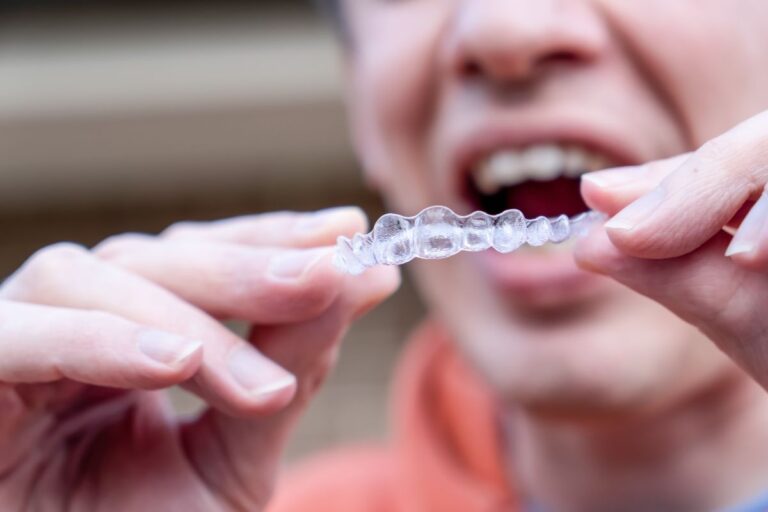 Patient holding Invisalign aligners for daily dental treatment