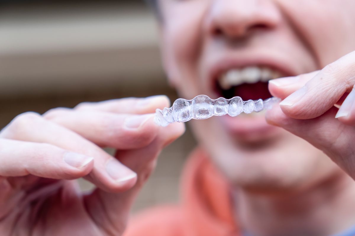 Patient holding Invisalign aligners for daily dental treatment