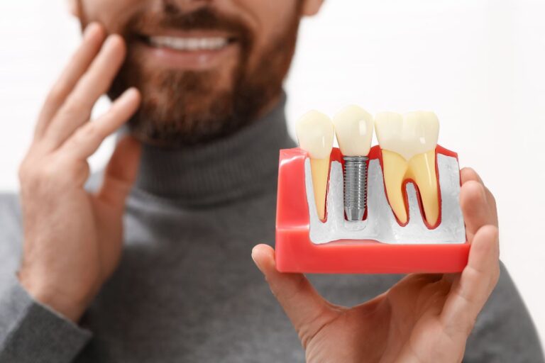 Patient experiencing metallic taste after dental implant surgery