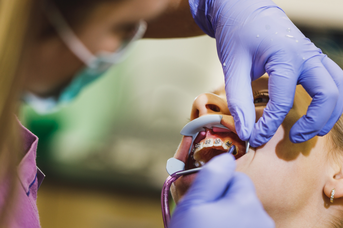 Orthodontist examines patient's metal braces during dental checkup and treatment evaluation.