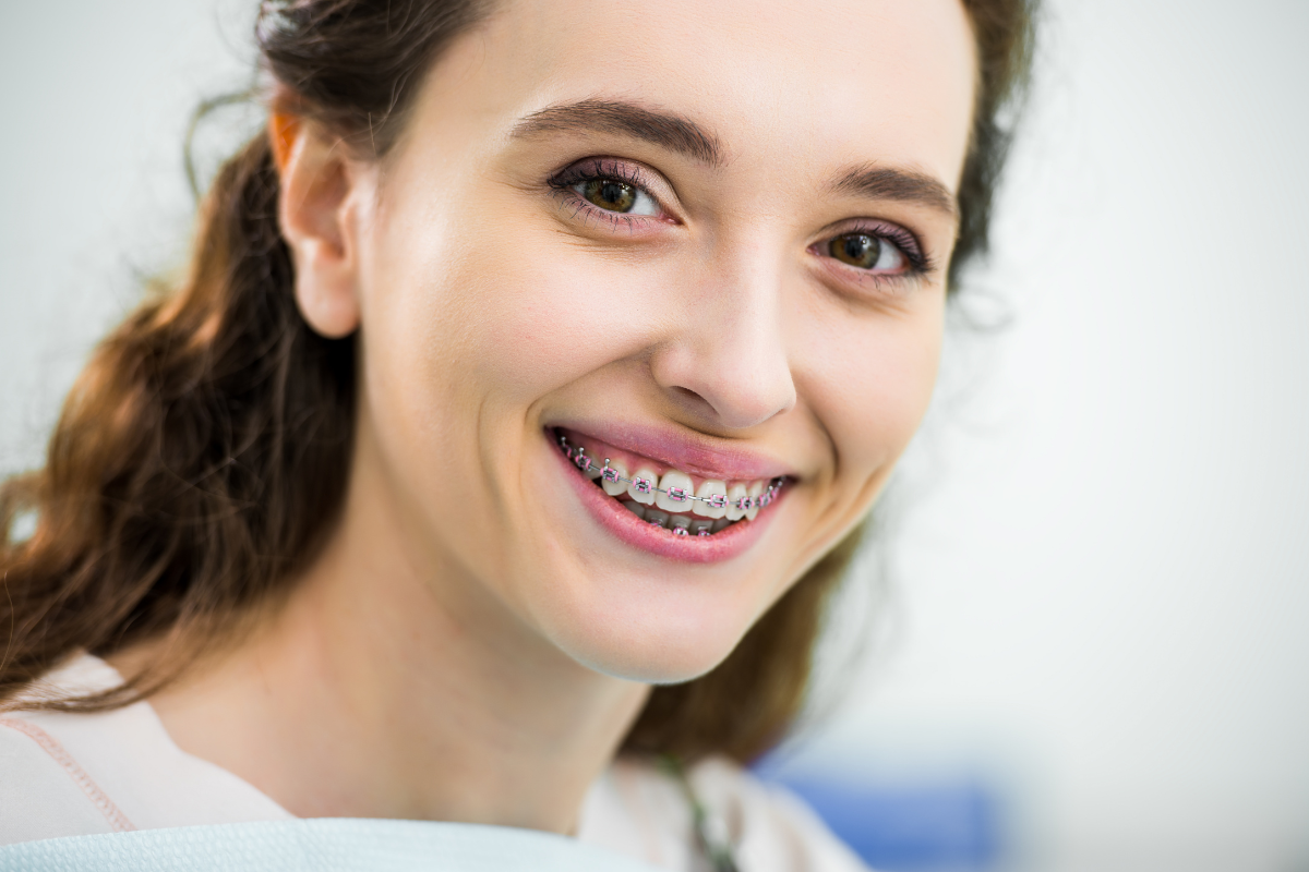 braces in San Antonio