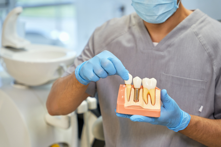 Dental Implant in San Antonio